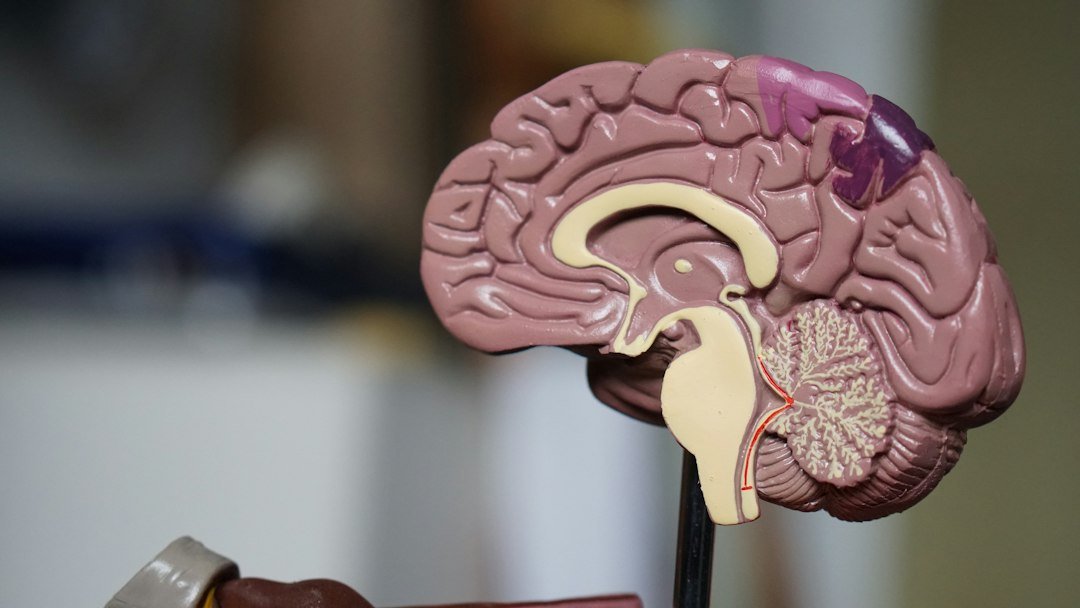 Adana beyin ve sinir cerrahisi uzmanı değerlendirmesinde beyin anatomisini gösteren temsili model