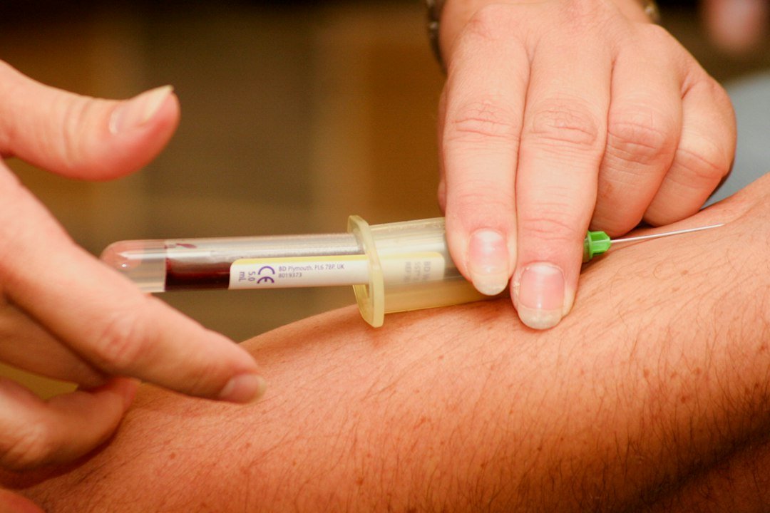 B12 eksikliği değerlendirmesinde kan testini temsil eden tıbbi görsel