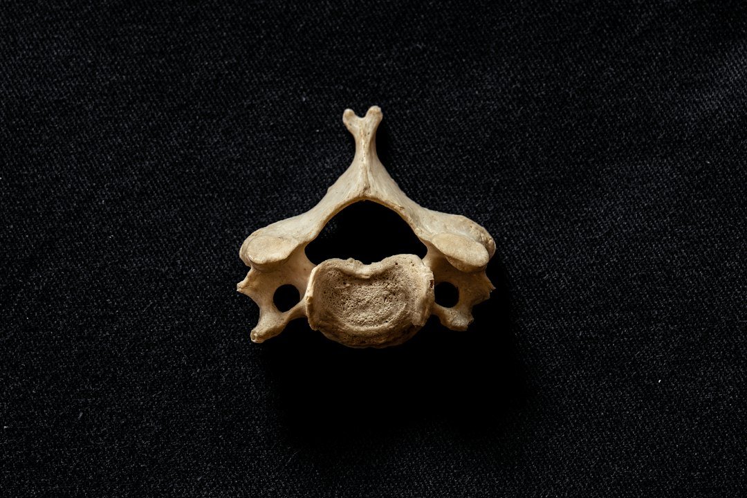 Boyun fıtığında kola vuran ağrı ve sinir basısını değerlendirmede servikal omur anatomisini temsil eden görsel